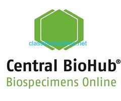 Aqueous Humor in Research | Order Biospecimens Online